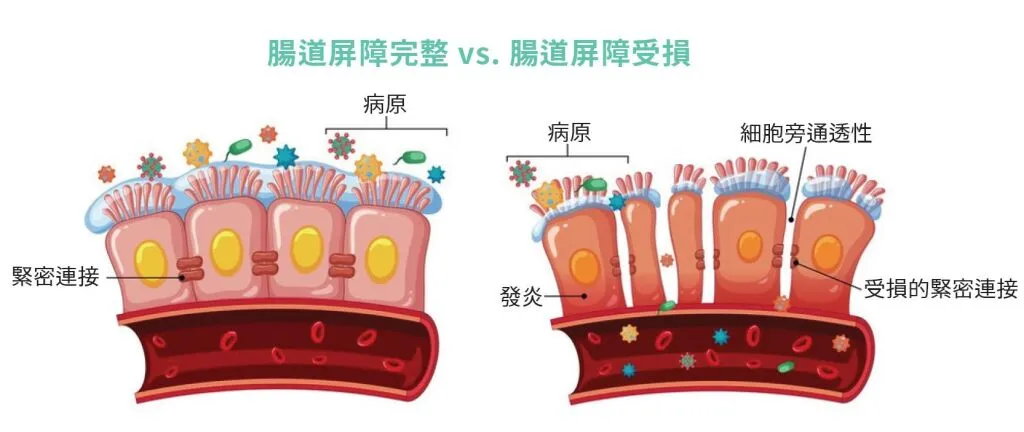 腸道屏障完整與腸道屏障受損示意圖