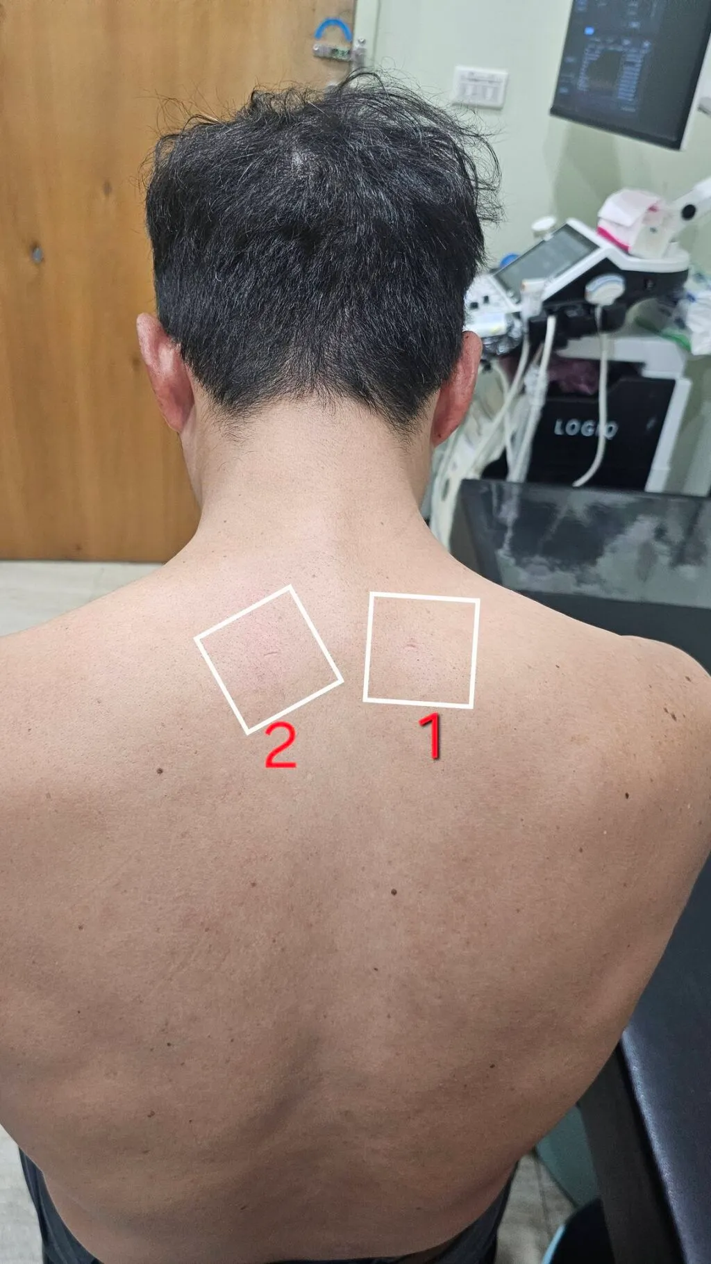 侯鐘堡醫師_上斜方肌