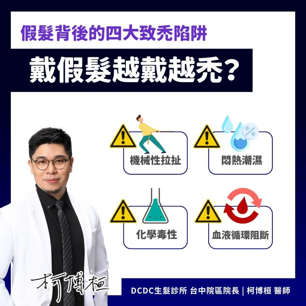 柯博桓醫師_假髮越戴越禿