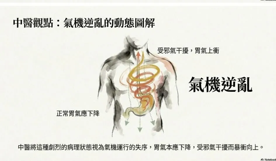 余雅雯中醫師＿為什麼得諾羅會噴射性嘔吐？中醫觀點