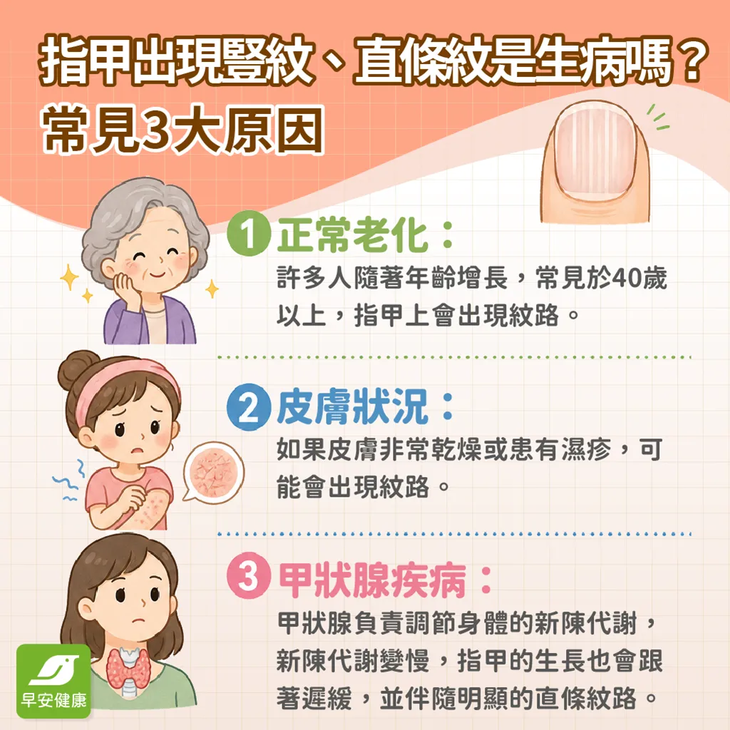 指甲出現豎紋-指甲直條紋是生病嗎-指甲豎紋原因