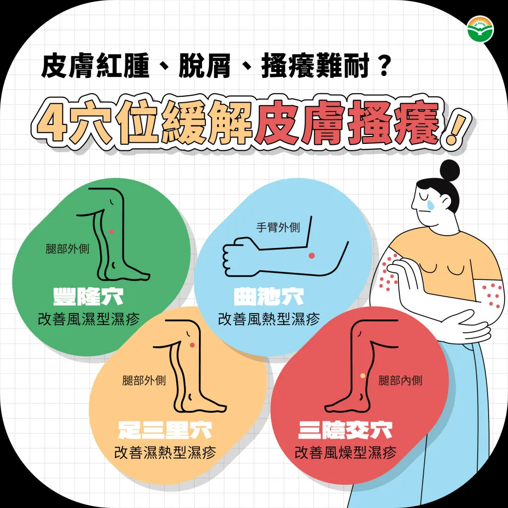 馬光中醫_4穴位緩解皮膚瘙癢