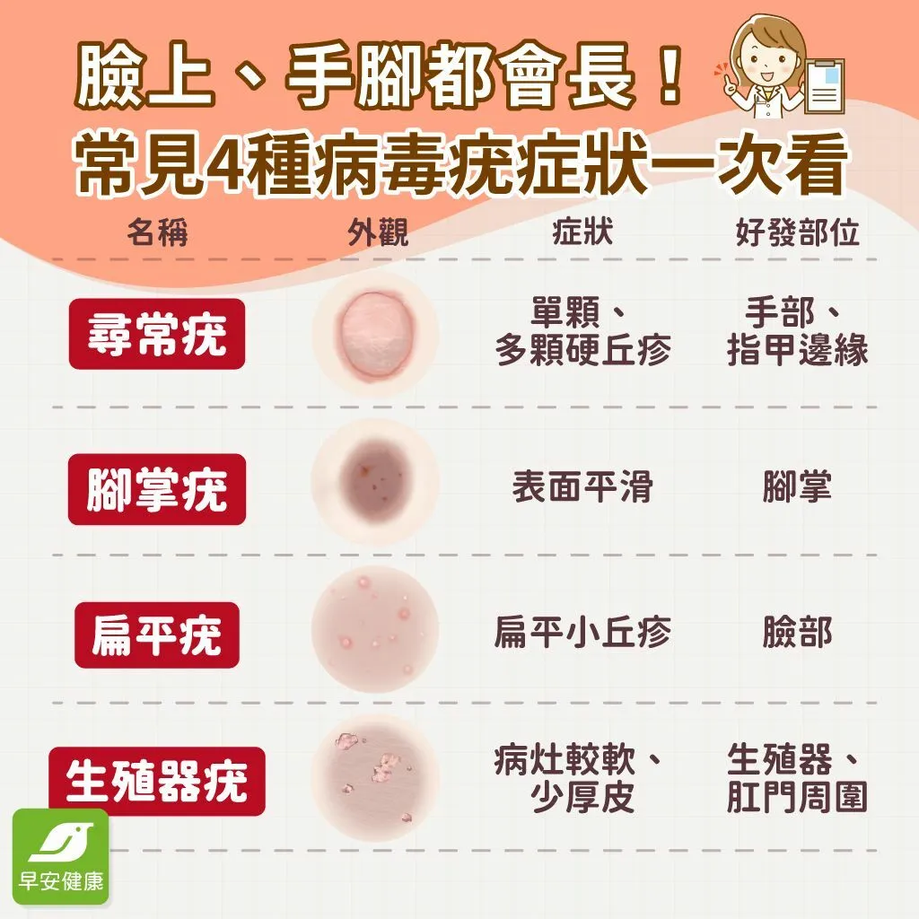 早安健康_4種常見病毒疣