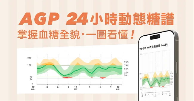 AGP（Ambulatory Glucose Profile，二十四小時動態糖譜）也是解讀 CGM 不可或缺的工具.jpg