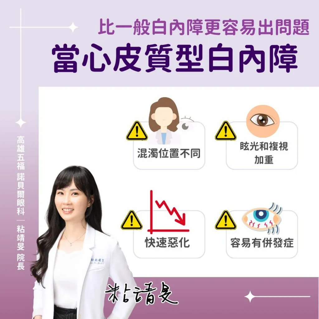 粘靖旻眼科女醫師_皮質型白內障