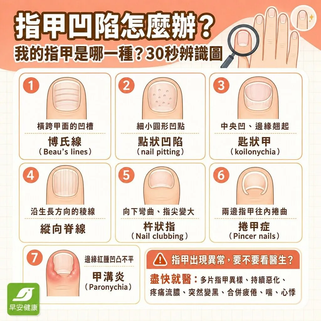早安_指甲凹陷怎麼辦？