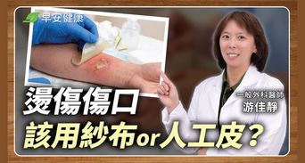 燙傷擦蘆薈錯了？外科醫揭「正確急救法」這動作讓傷口更慢好