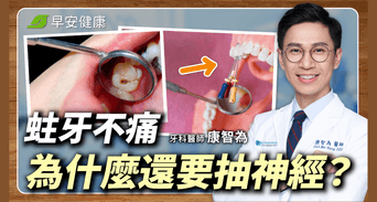 抽神經等於牙齒沒救了？大錯！但術後照護少做三件事就白費了