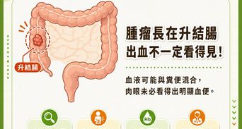 沒血便竟已大腸癌三期！35歲工程師健檢一指數降，驚覺升結腸腫瘤