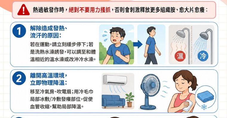 運動、流汗就熱過敏？膽鹼性蕁麻疹症狀、原因與止癢舒緩3招