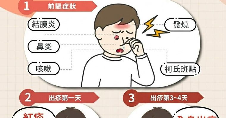 麻疹是什麼？初期症狀與感冒差異、傳染途徑與柯氏斑特徵