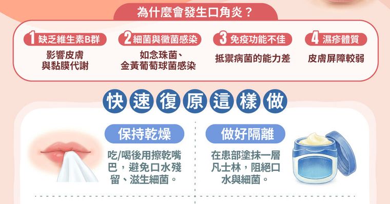 口角炎擦什麼藥？解密「臭嘴角」原因與快速修復SOP