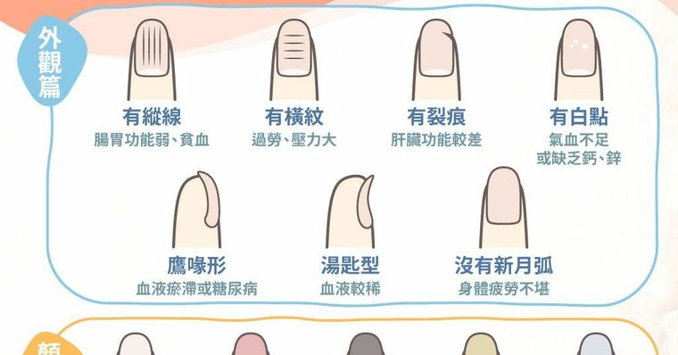 指甲沒月牙，代表身體在生病？指甲顏色與外觀暗示你健康亮紅燈！