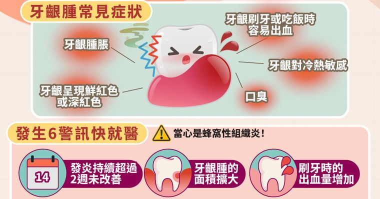 牙齦腫會自己好嗎？牙齦發炎9大原因、症狀與快速消腫法