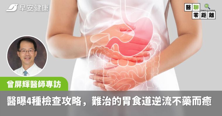 一直打嗝＋胃酸好難受！分辨「真逆流、假逆流」台大醫曝4種檢查攻略