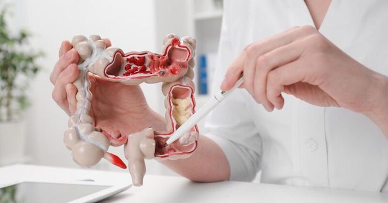不只大腸鏡！台大最新4百萬人研究揭「一指標」精準防大腸癌