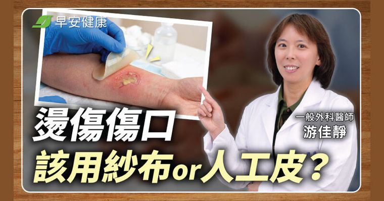 燙傷擦蘆薈錯了？外科醫揭「正確急救法」這動作讓傷口更慢好