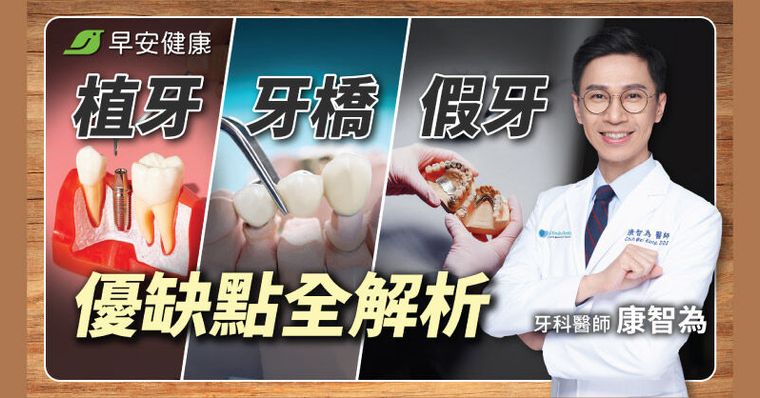 植牙好還是牙橋好？名醫吐真話：先懂3重點，保證少走冤枉路