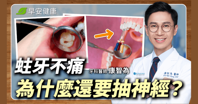 抽神經等於牙齒沒救了？大錯！但術後照護少做三件事就白費了