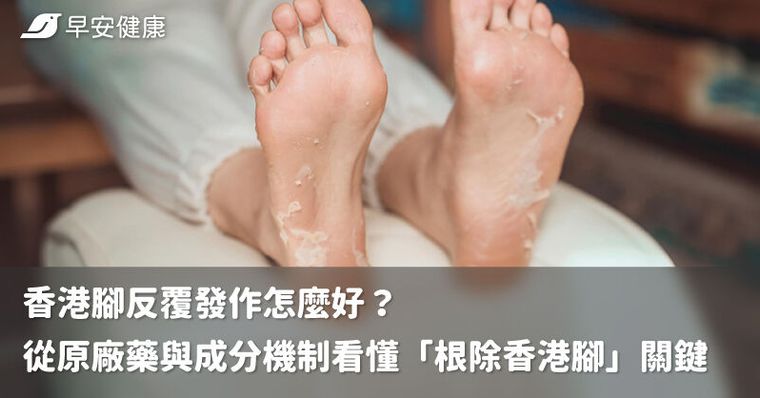 香港腳反覆發作怎麼好？從原廠藥與成分機制看懂「根除香港腳」關鍵