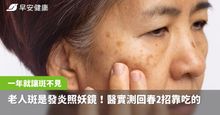 老人斑是體內發炎的照妖鏡！醫實測回春2招「靠吃的」僅一年就讓斑不見