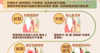 蛀牙原因與症狀？牙痛沒黑點是蛀牙嗎？補牙材質與預防全解析