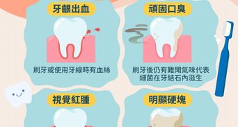 洗牙會讓牙縫變大嗎？健保洗牙多久洗一次、費用與洗後飲食禁忌