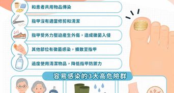 灰指甲症狀有哪些？治療灰指甲最好辦法與偏方迷思全解析