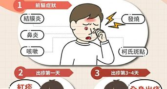 麻疹症狀像感冒？麻疹傳染途徑、潛伏期與疫苗接種懶人包