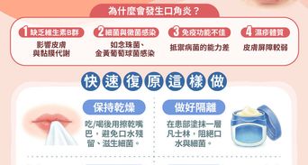口角炎擦什麼藥？解密「臭嘴角」原因與快速修復SOP