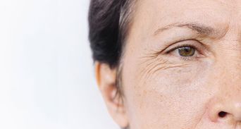 照鏡子看眼角！研究：長得越「糙老」失智風險可能高6成