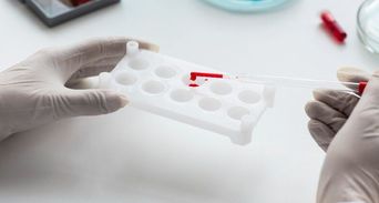 「一滴血」揪癌王！台大新技術登頂尖期刊，微量血液秒抓早期胰臟癌