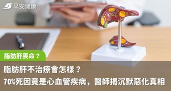脂肪肝不治療會怎樣？70%死因竟是心血管疾病，醫師揭沉默惡化真相