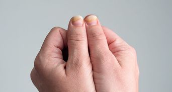 黃仁勳指甲灰黑引熱議！這6種可能原因常被誤認為灰指甲