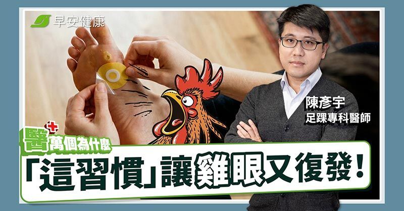 雞眼長在哪代表腳出事了！足踝名醫「3招斷根」不靠貼布告別疼痛