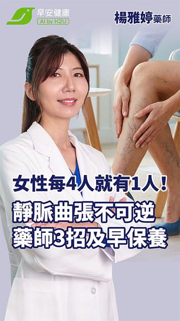 女性每4人就有1人！靜脈曲張不可逆，藥師3招及早保養