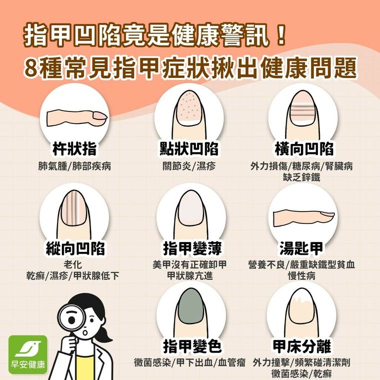 指甲凹陷、橫紋恐是肝腎出問題！8徵兆看出健康警訊