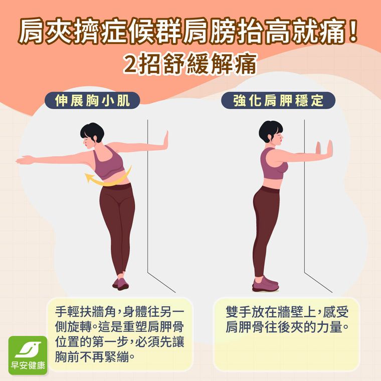 肩夾擠症候群是什麼？自我檢測、疼痛角度與肩夾擠復健指南