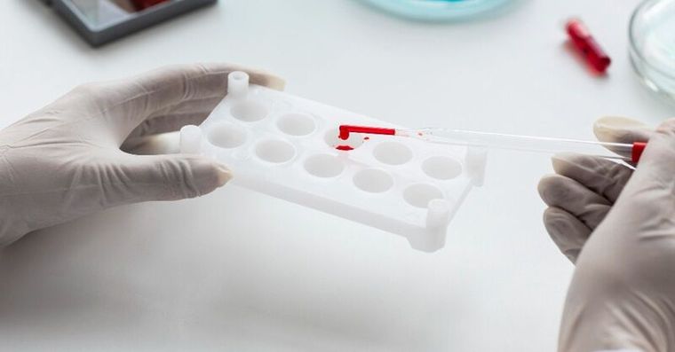 肚子悶痛、消化不良？小心是胰臟在求救！台大研發「一滴血」讓早期癌王現形