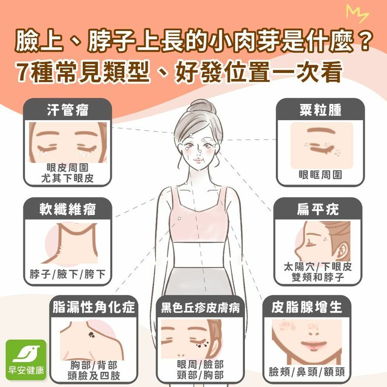 肉芽是什麼？脖子、臉上長肉芽原因，自我照顧＆治療方法
