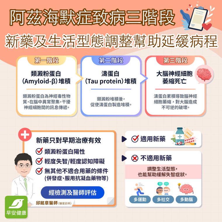 醫詳解阿茲海默症大腦「崩壞三部曲」  新藥5大關鍵問答一次看懂
