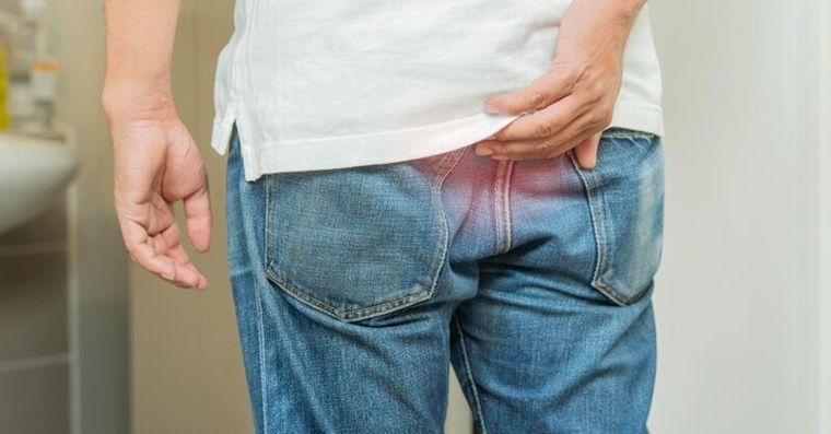 痔瘡竟是癌症煙霧彈？44歲男驚見3公分腫瘤「這病史」風險飆3倍