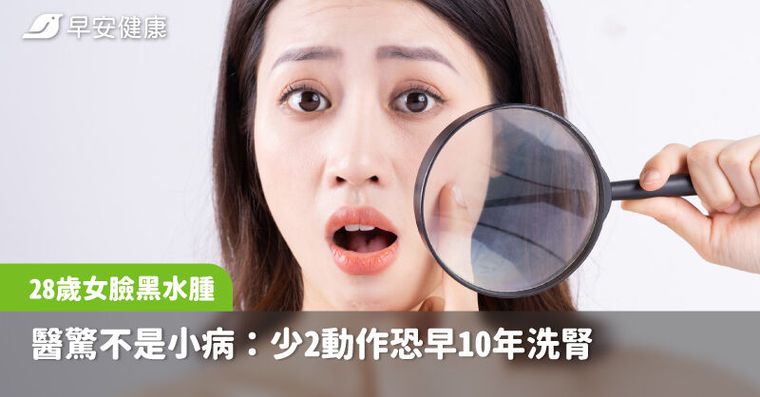28歲女臉黑水腫、啤酒尿，醫驚不是小病：少2動作恐早10年洗腎