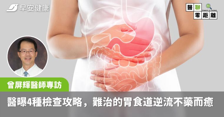 一直打嗝＋胃酸好難受！分辨「真逆流、假逆流」台大醫曝4種檢查攻略