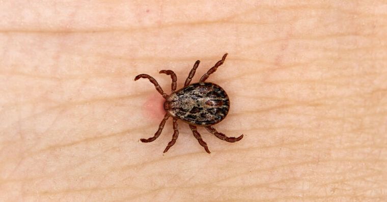 被蜱蟲咬怎麼辦？被蜱蟲咬別硬拔，正確處理5步驟與預防