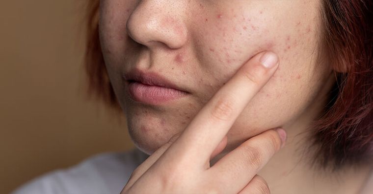 戒掉「假保養」！皮膚科醫教2招找回發光少女肌，年後不變黃臉婆