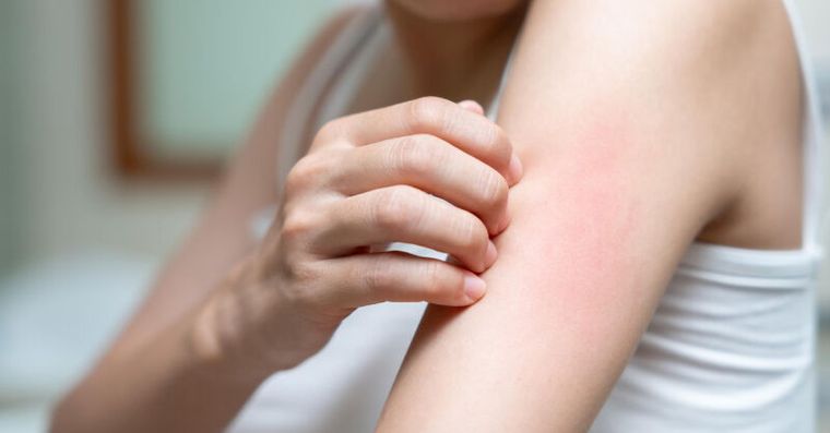 擦了乳液還是皮膚癢？醫推「這時間」是黃金潤膚期保濕力加倍