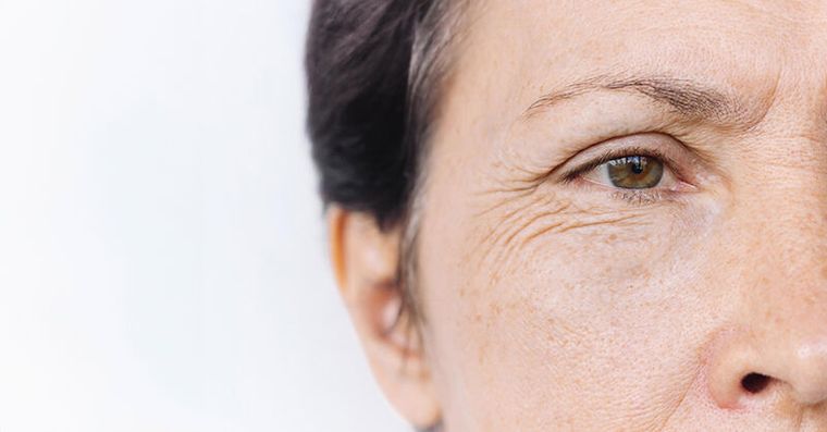 照鏡子看眼角！研究：長得越「糙老」失智風險可能高6成