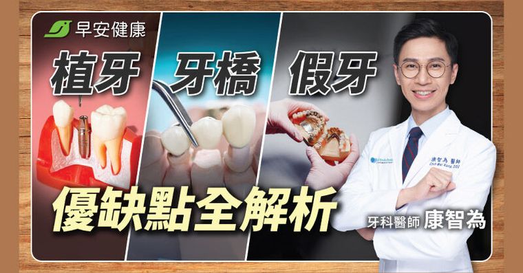 植牙好還是牙橋好？名醫吐真話：先懂3重點，保證少走冤枉路