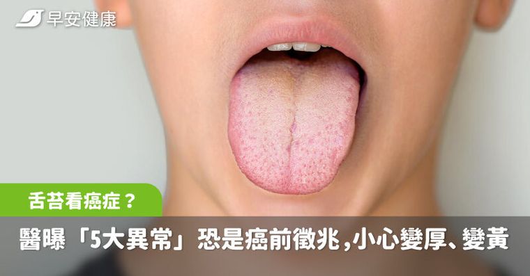 舌苔看癌症？醫曝「5大異常」恐是癌前徵兆，變厚、變黃要小心了
